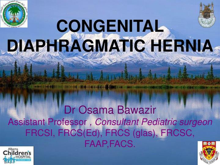 Ppt Congenital Diaphragmatic Hernia Dr Osama Bawazir Powerpoint