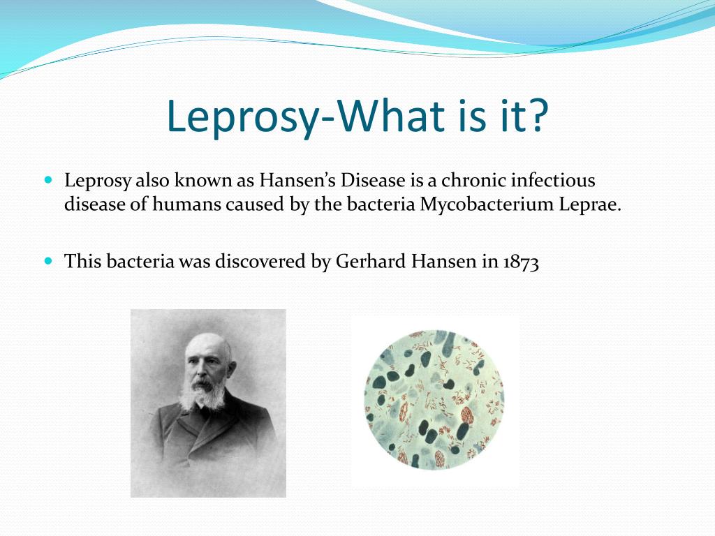 Реферат: Leprosy Essay Research Paper Leprosy or Hansen