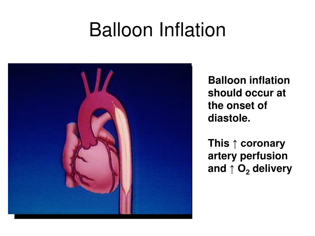 Should this occur. Inflation Balloon. Balloon girl inflation. Heart Torsion during systole.