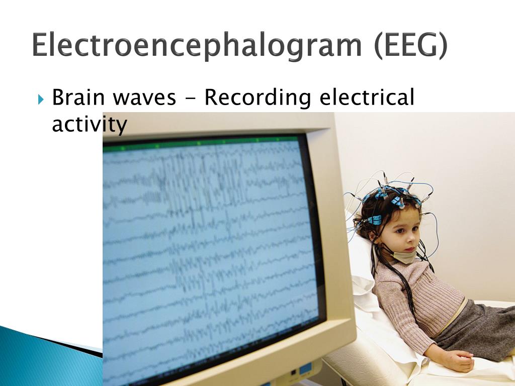 Eeg Introduction PPT - Unraveling the Neuroscience of Neurons: From Communication to ...