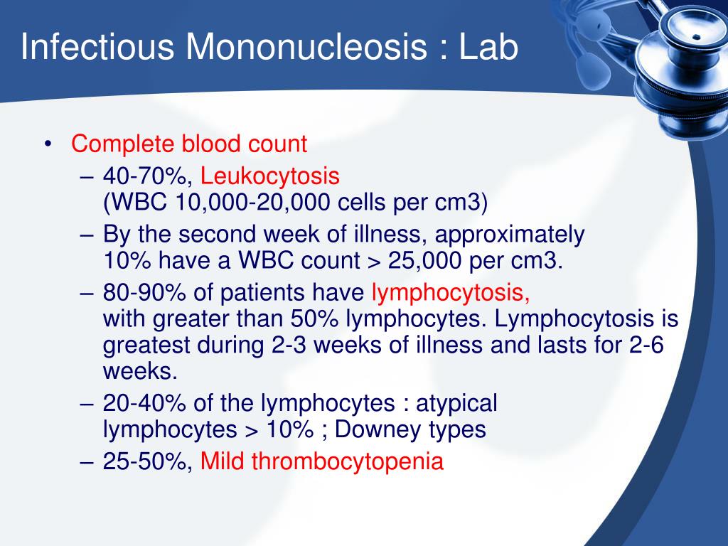 PPT - Infectious Mononucleosis. PowerPoint Presentation, free download - ID:3291291