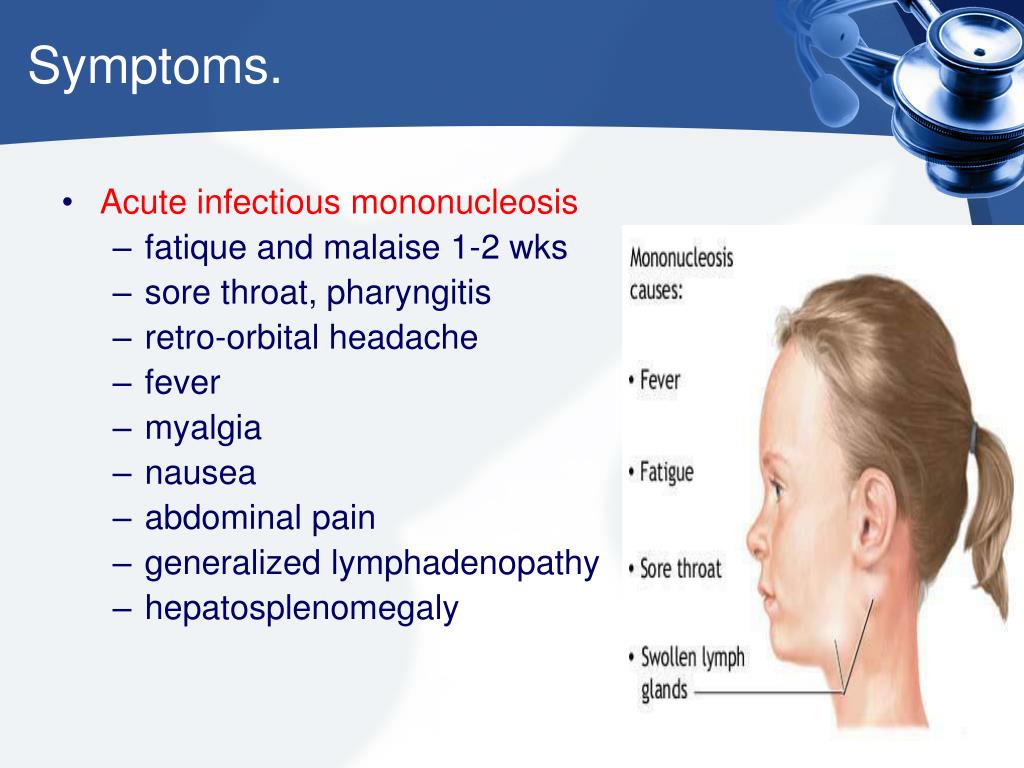 signs of mono signs of mono