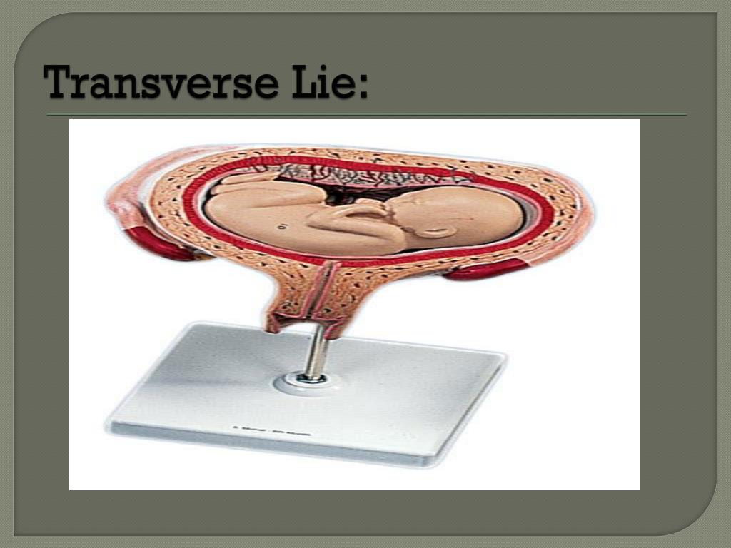 transverse lie the presentation is