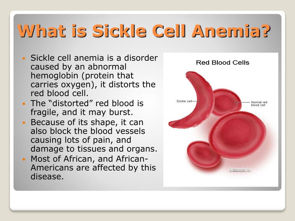 powerpoint presentation on sickle cell anemia