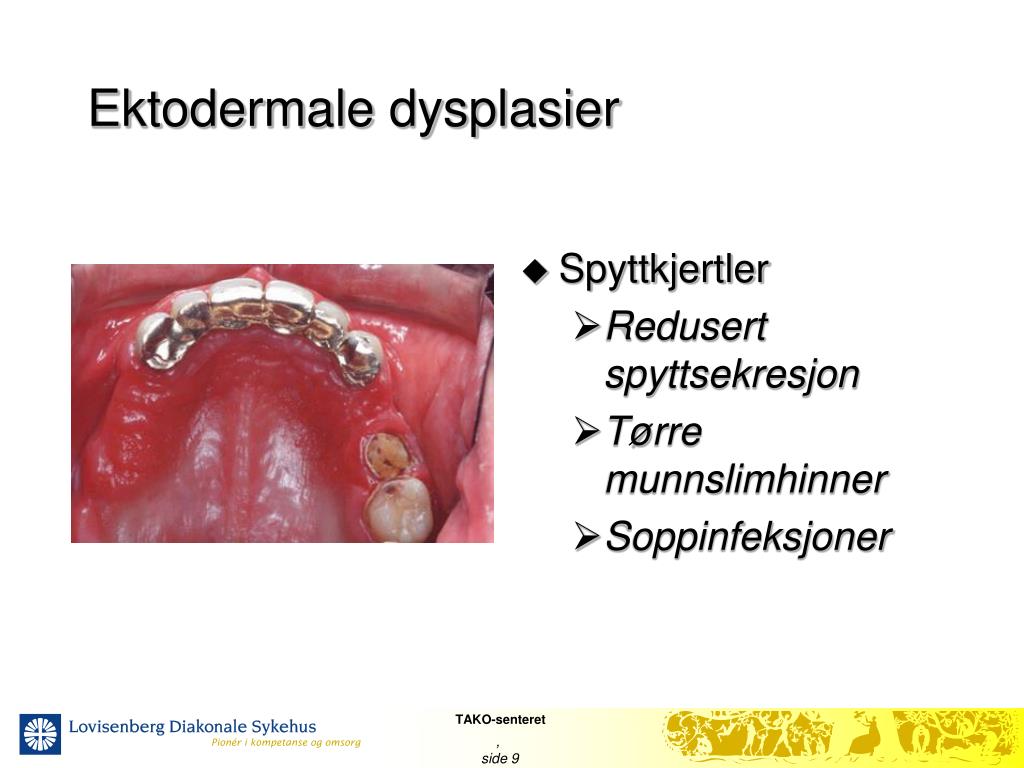 PPT - FOU-dag UNN 23.05 2008 TAKO-senteret og forskning PowerPoint ...