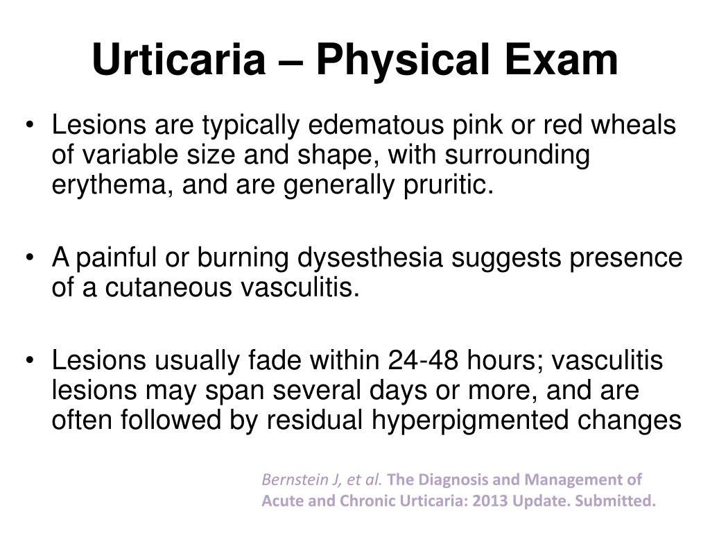 Ppt Chronic Urticaria New Management Options Powerpoint Presentation