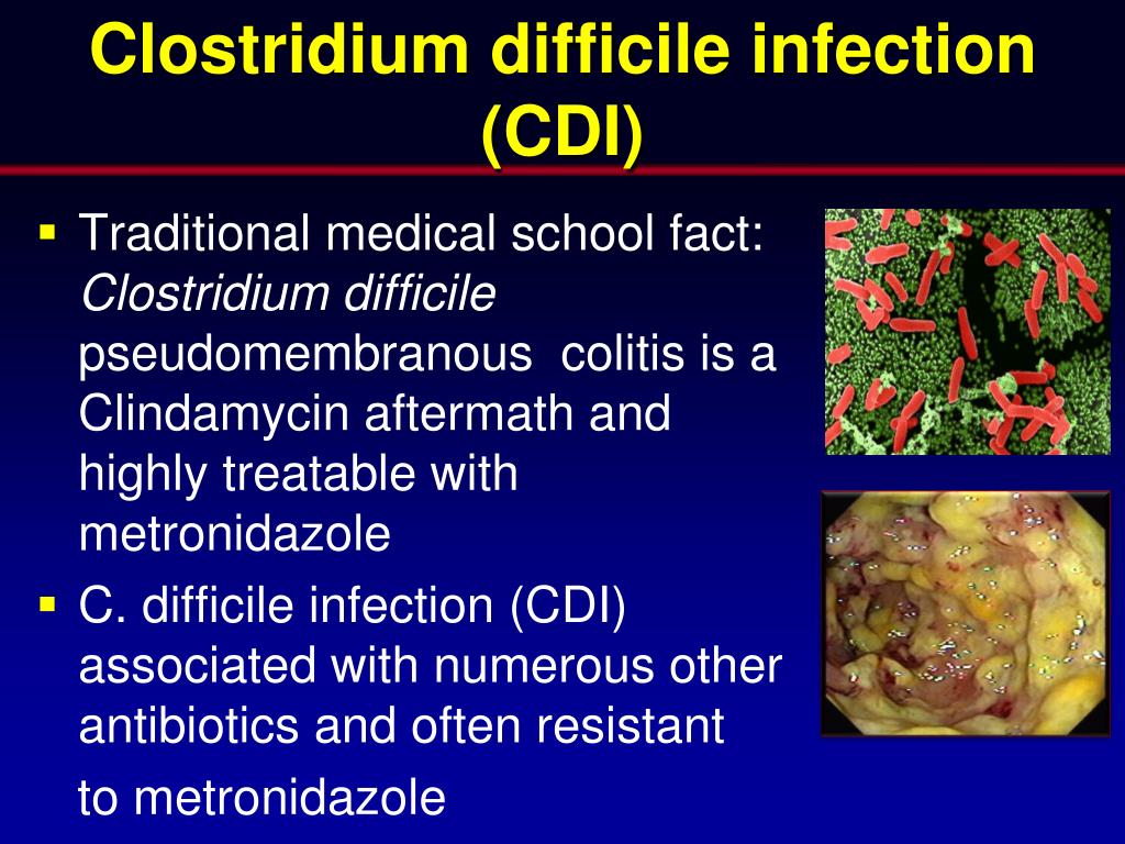 Токсин cl difficile. Клостридиум диффициле. Симптомы клостридий диффициле.