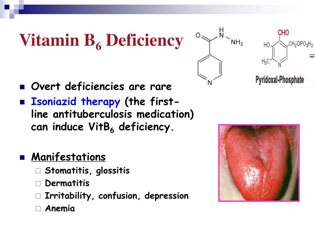 Vitamin deficiency. B6 defficiency. Витамин b6.