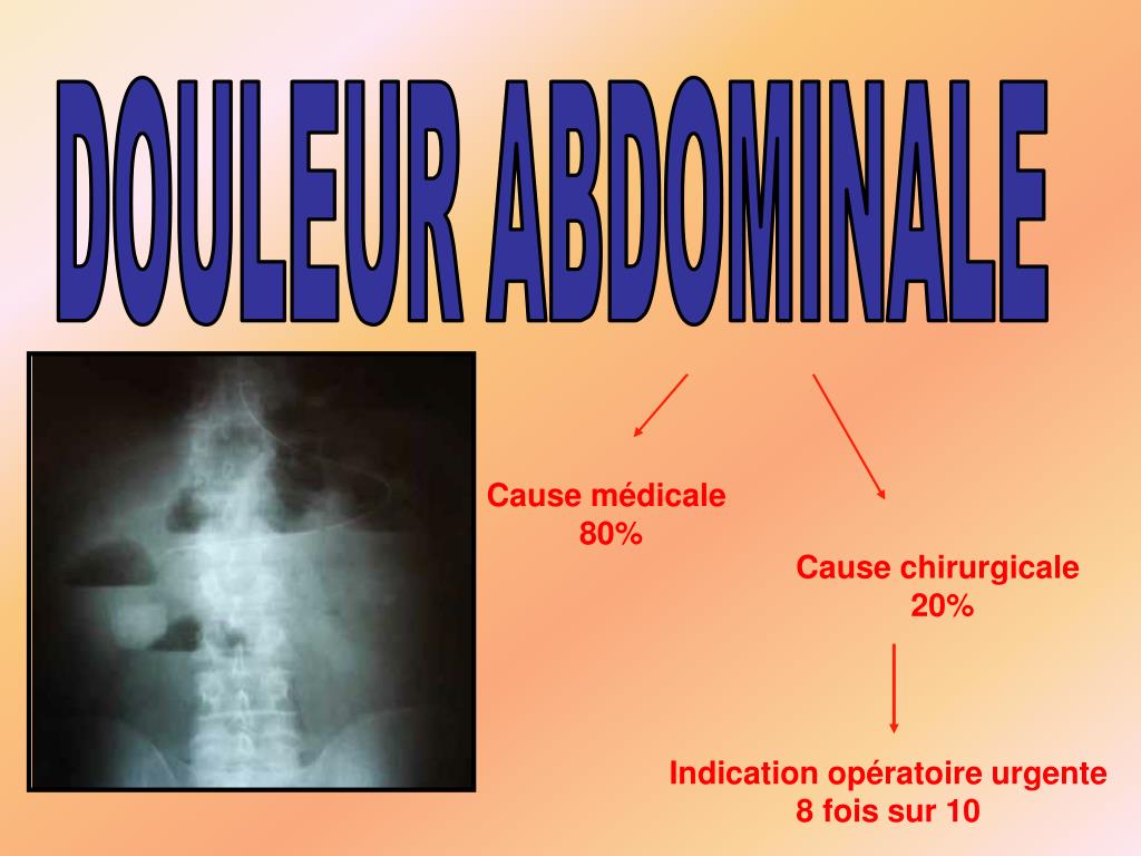 PPT - DOULEUR ABDOMINALE PowerPoint Presentation, free download - ID:3304160