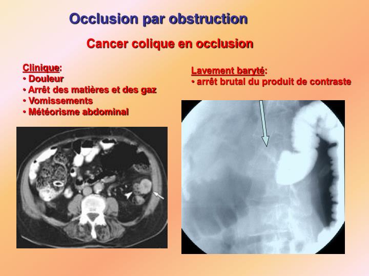PPT DOULEUR ABDOMINALE PowerPoint Presentation ID3304160