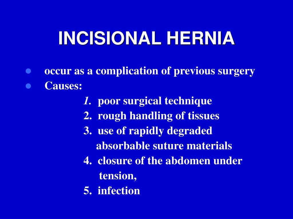 Ppt Case Presentation And Sharing Of Information On Incisional Hernia
