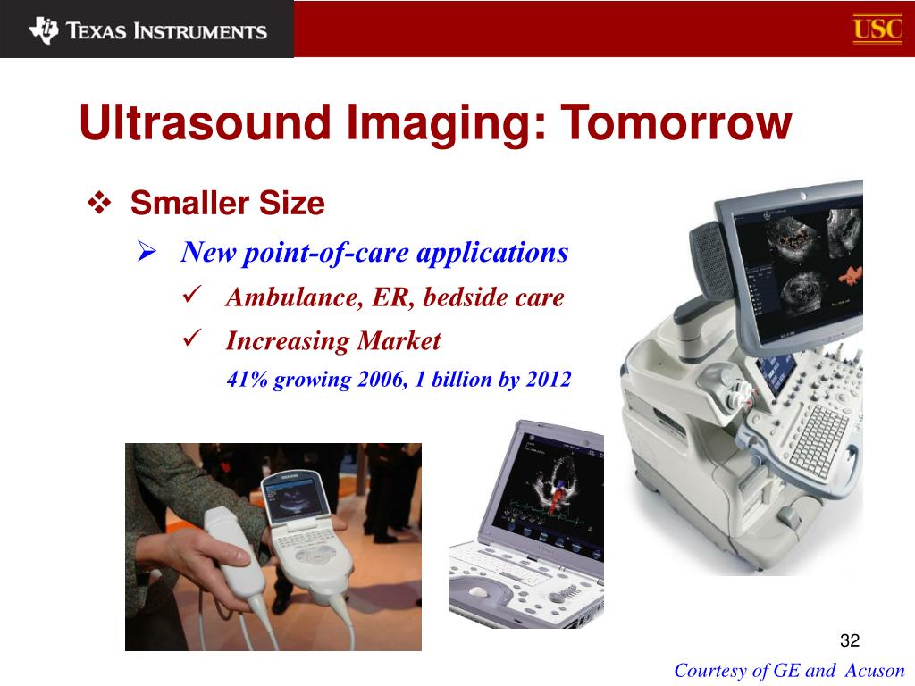 presentation in ultrasound