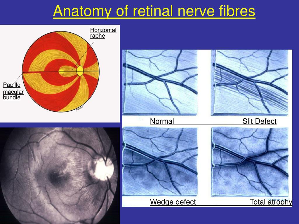PPT - DR.K.SUDHAMATHI CONSULTANT EYEQ SUPERSPECIALITY HOSPITALS ...