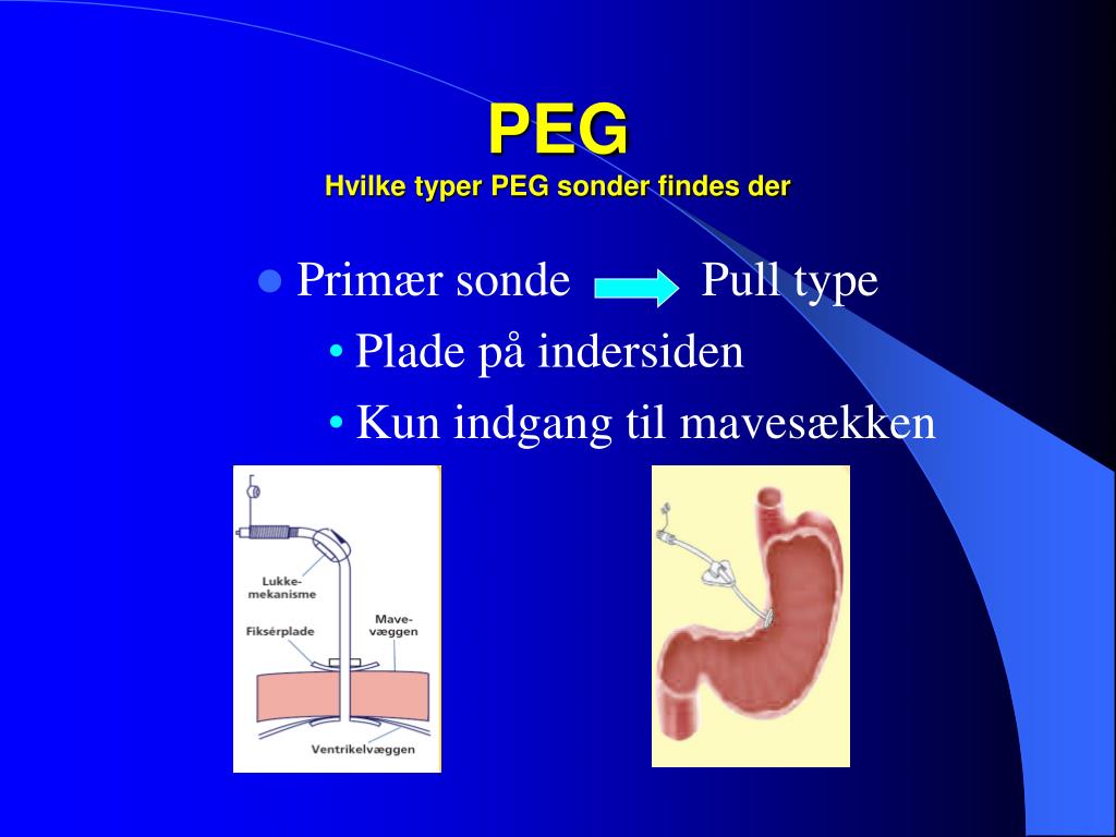 PPT - PEG PowerPoint Presentation, free download - ID:3321535