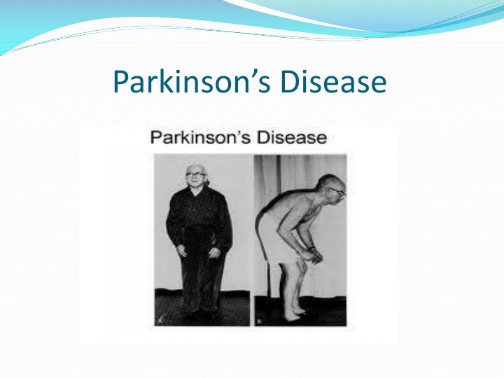 Ppt Parkinson S Disease Powerpoint Presentation Free