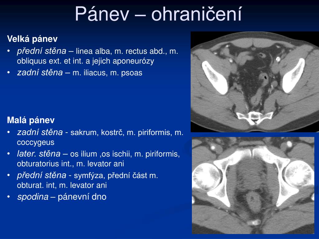 PPT - Anatomie pánve PowerPoint Presentation, free download - ID:3330062