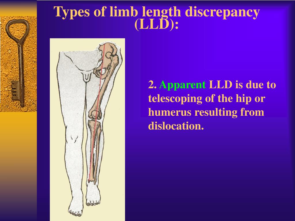 PPT - Contents of examination of orthopaedical patients PowerPoint ...