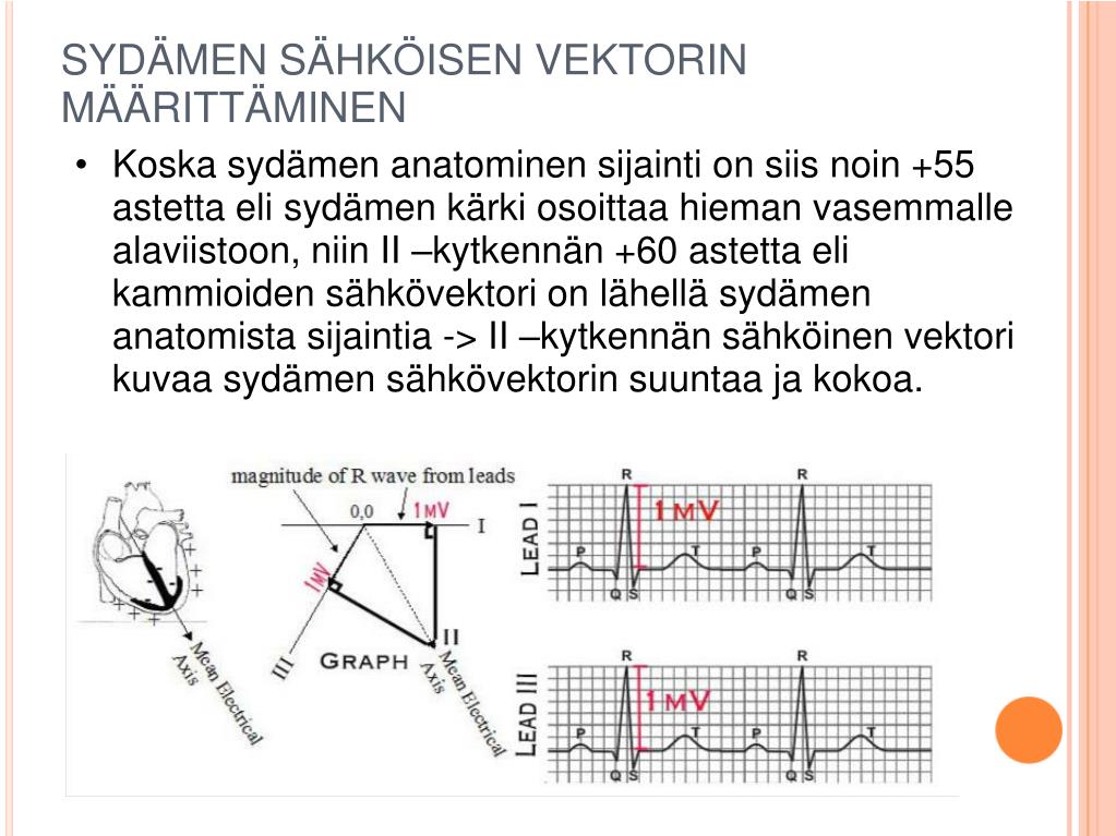 PPT - Sydän ja EKG II PowerPoint Presentation, free download - ID:3331993