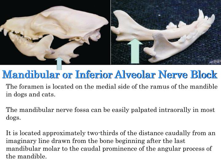 PPT How to Administer Dental Nerve Blocks A Training Guide PowerPoint