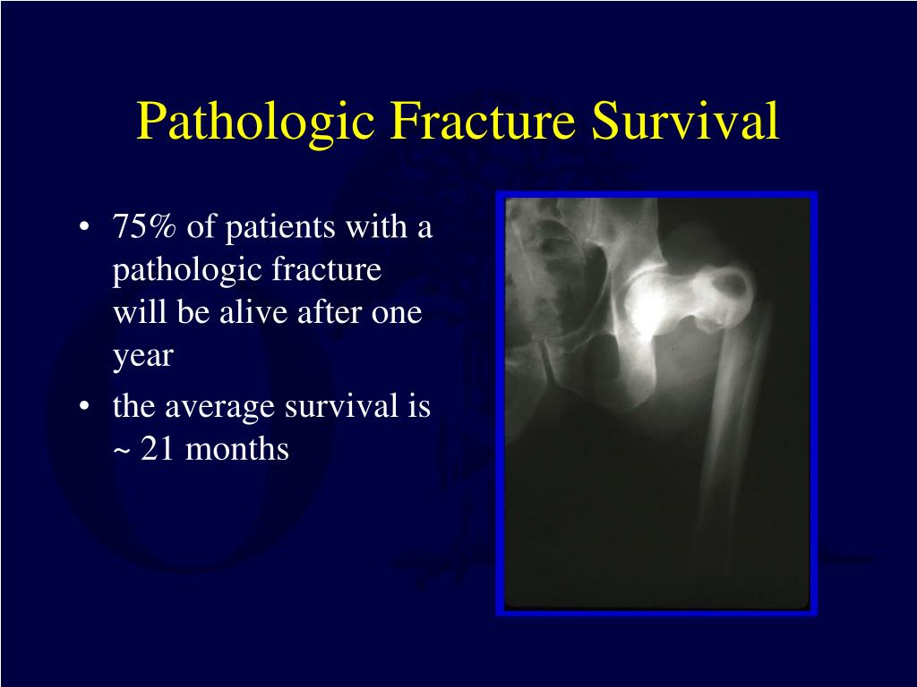 pathological fracture cancer