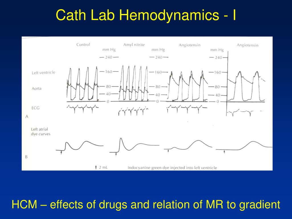 PPT CathLab Hemodynamics I Pressure tracings in the diseased