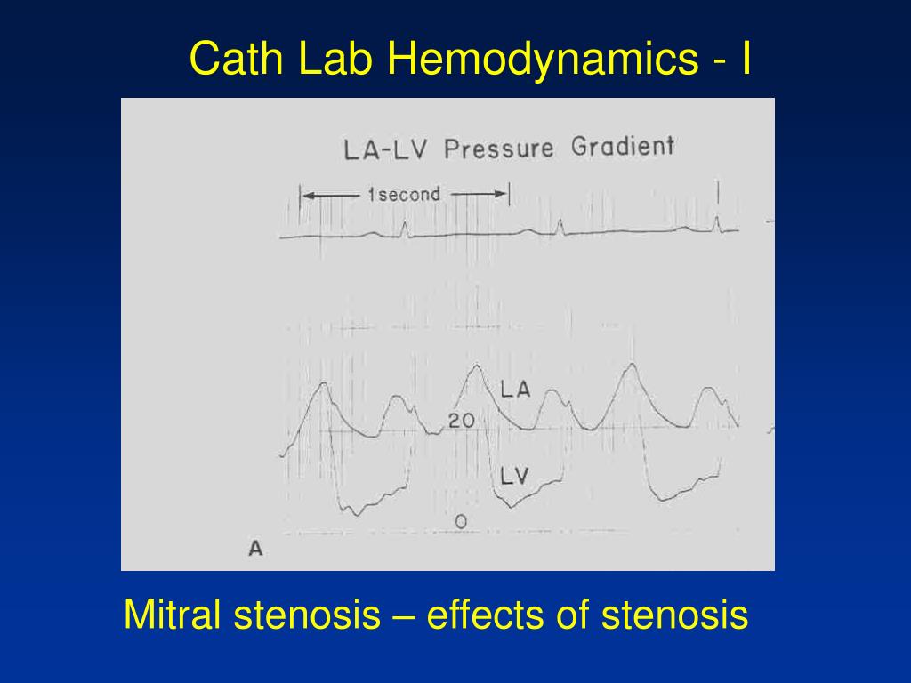 PPT CathLab Hemodynamics I Pressure tracings in the diseased