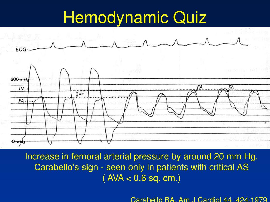 PPT CathLab Hemodynamics I Pressure tracings in the diseased