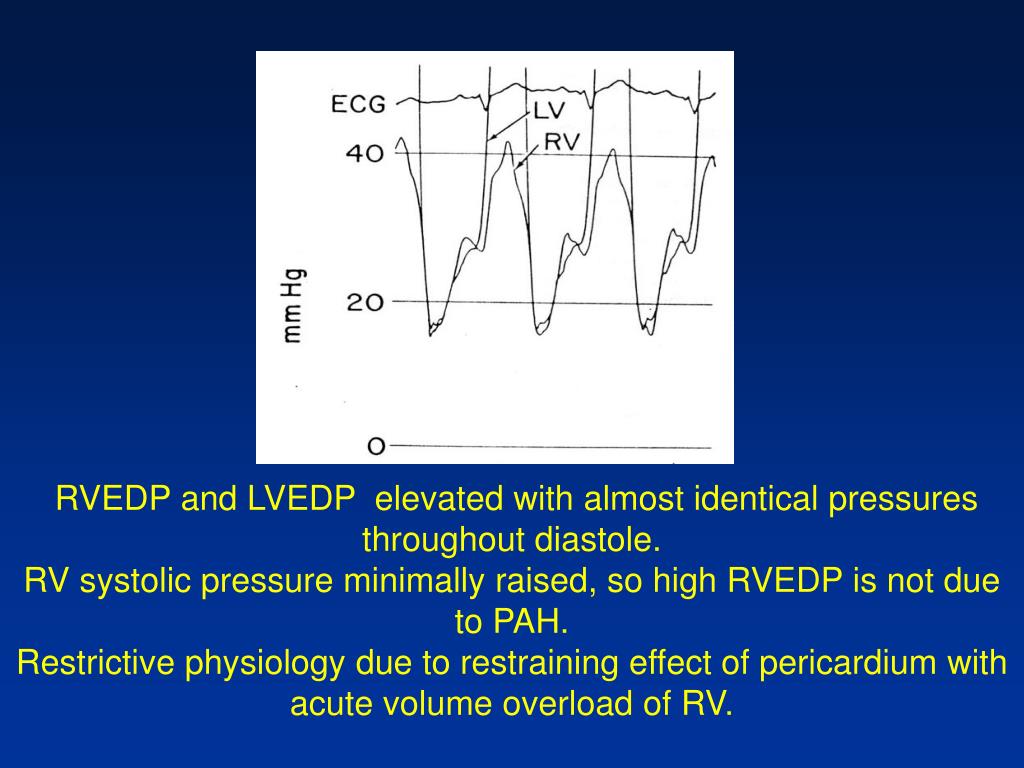 PPT CathLab Hemodynamics I Pressure tracings in the diseased