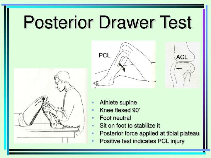 PPT Femur Patellar surface femur Lateral condyle & epicondyle Head PPT Femur Patellar surface femur Lateral condyle & epicondyle Head