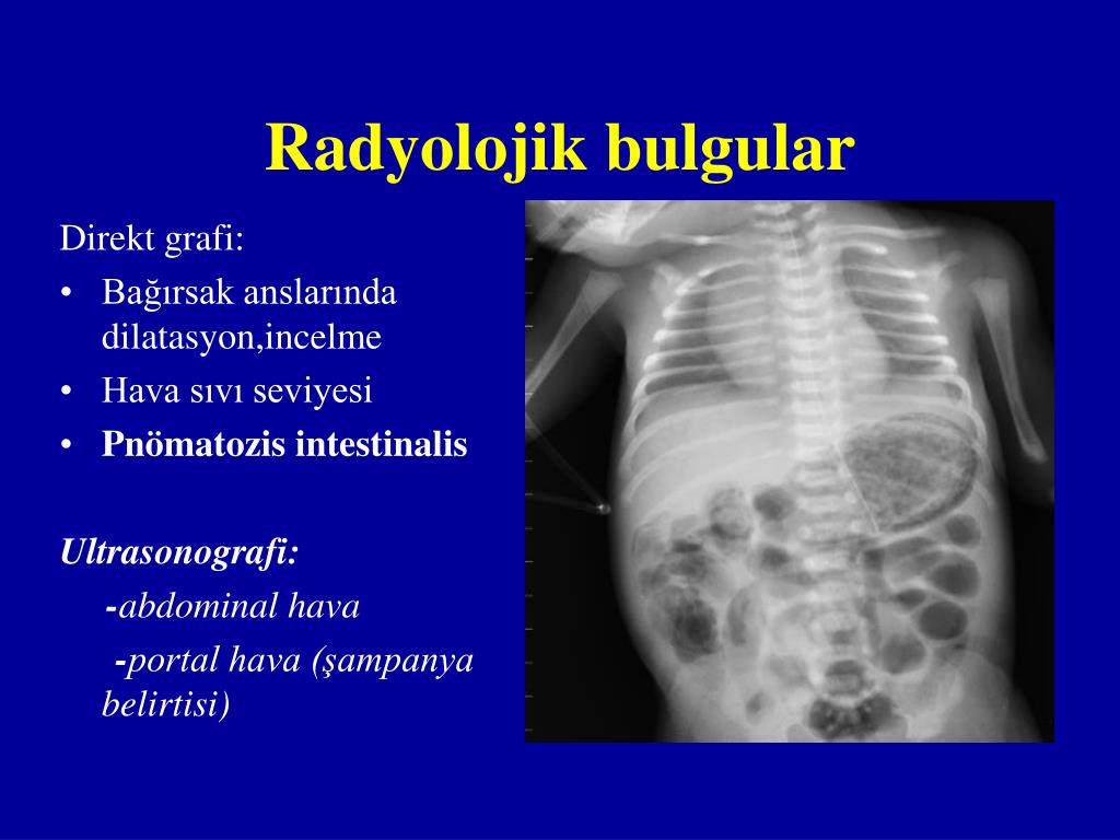 PPT Kocaeli Üniversitesi Tıp Fakültesi Çocuk Sağlığı ve Hastalıkları