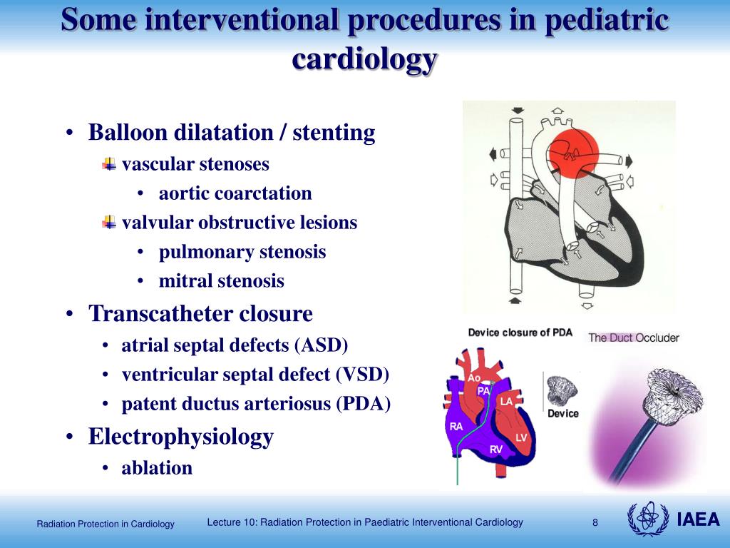 PPT - Radiation Protection in Paediatric Interventional Cardiology ...