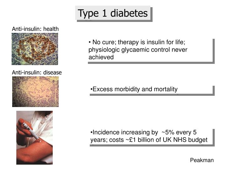 type one diabetes presentation
