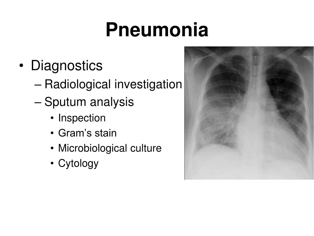 adventitious breath sounds of pneumonia adventitious breath sounds of pneumonia