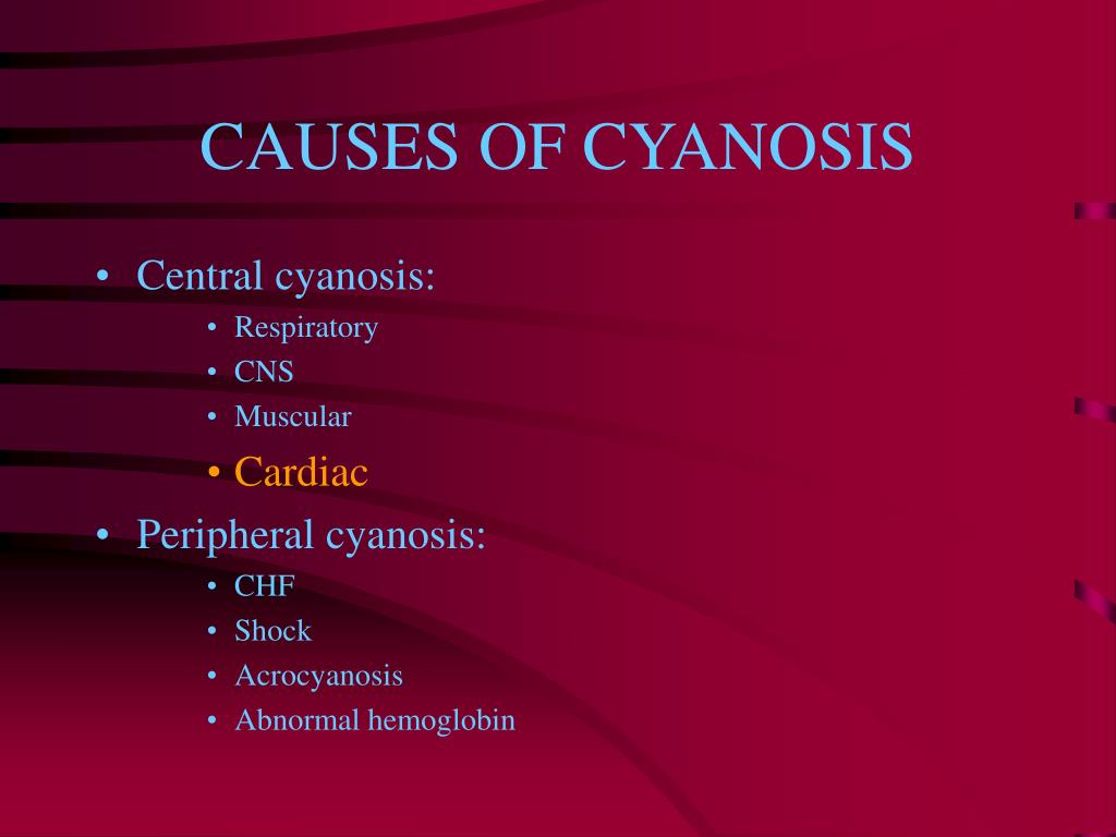 peripheral cyanosis vs central cyanosis