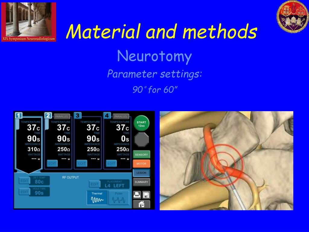 PPT PERCUTANEOUS RF NEUROTOMY IS EFFECTIVE IN THE TREATMENT OF FACET