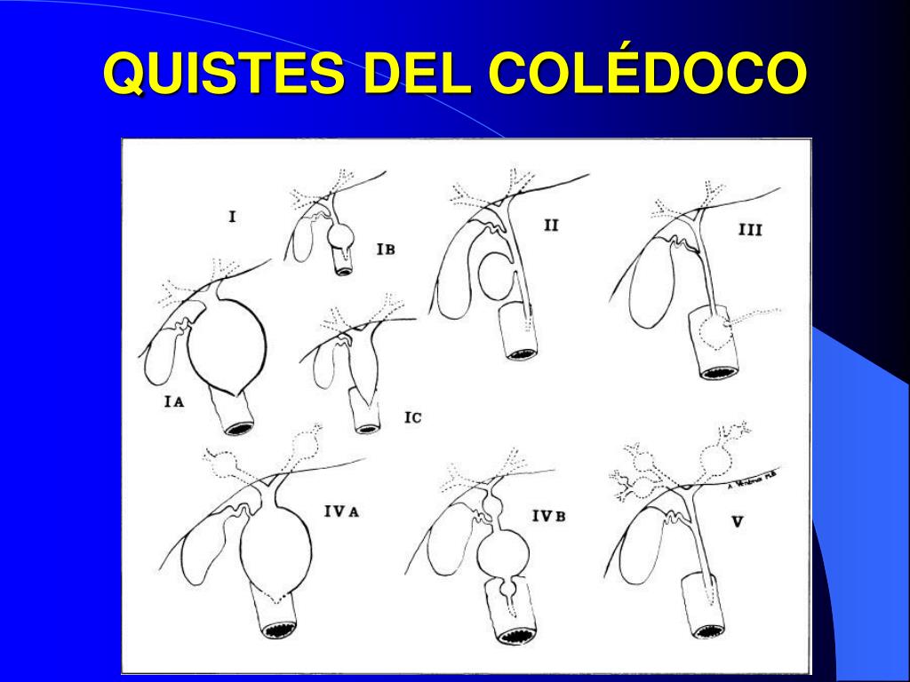PPT - TUMORES MALIGNOS DE VÍAS BILIARES PowerPoint Presentation, free ...