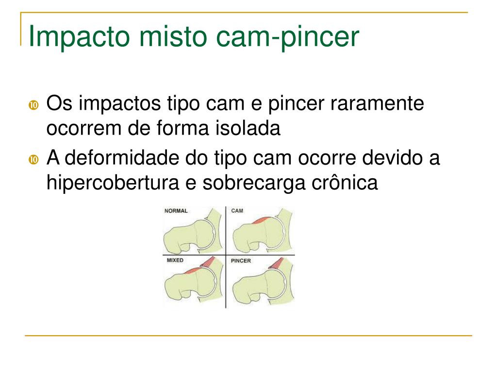 PPT - Impacto Femoroacetabular Dr. André Gaudêncio Ignácio de Almeida  PowerPoint Presentation - ID:3369792