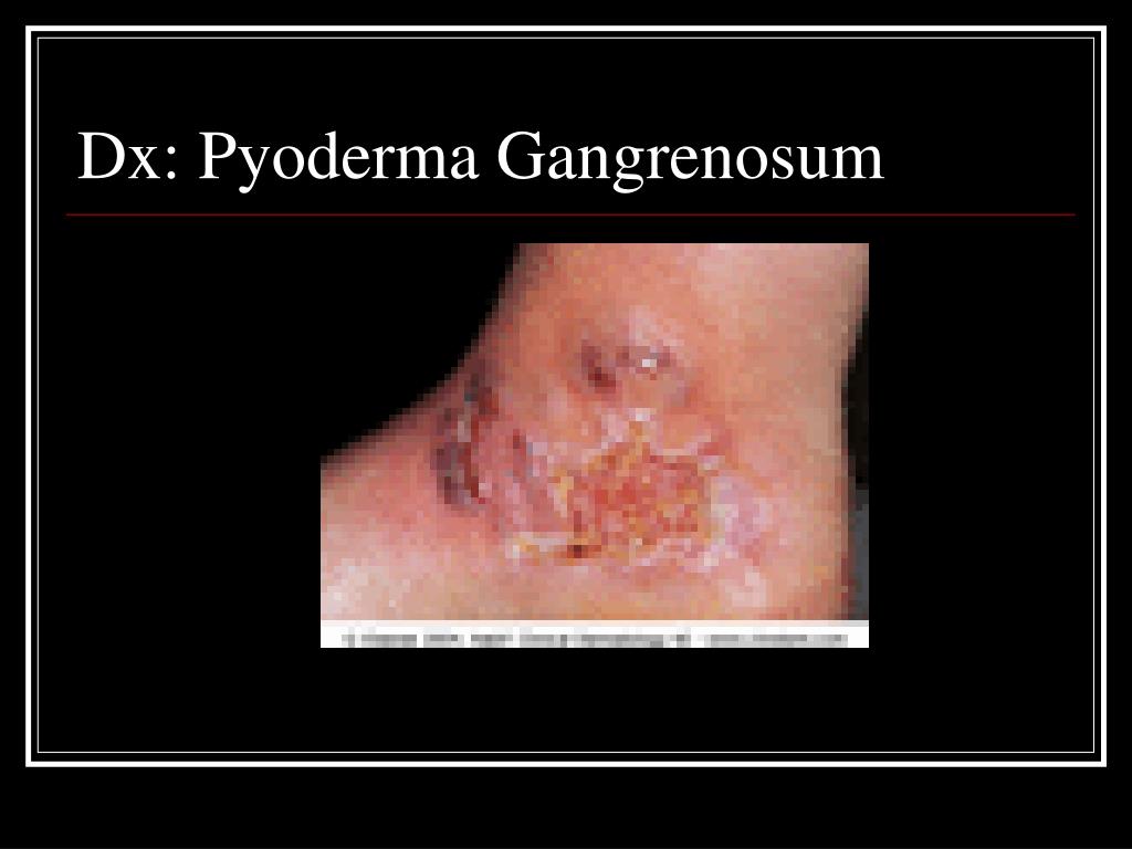 PPT The Scar That Wouldn t Heal PowerPoint Presentation Free 