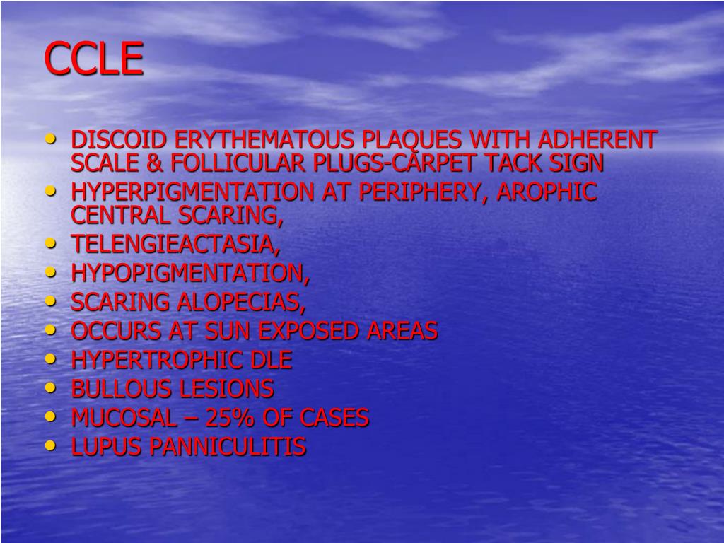Ppt Systemic Lupus Erythematosus Powerpoint Presentation Free Id 3376397