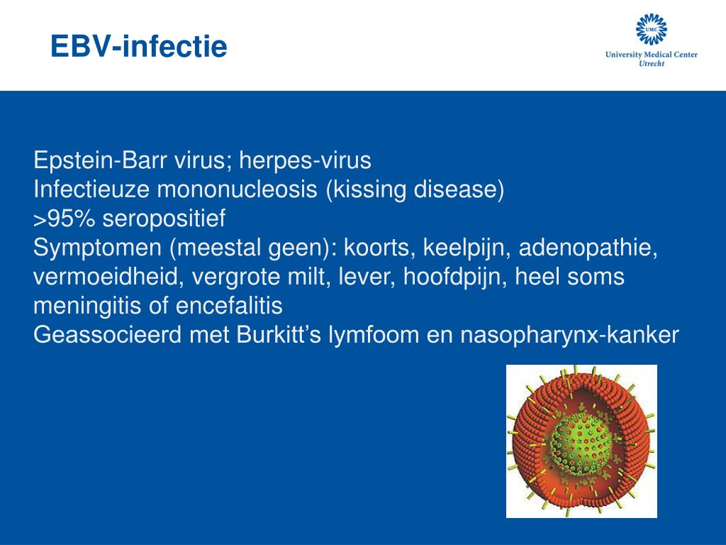 Ebv. Epstein Barr virus что это за вирус.