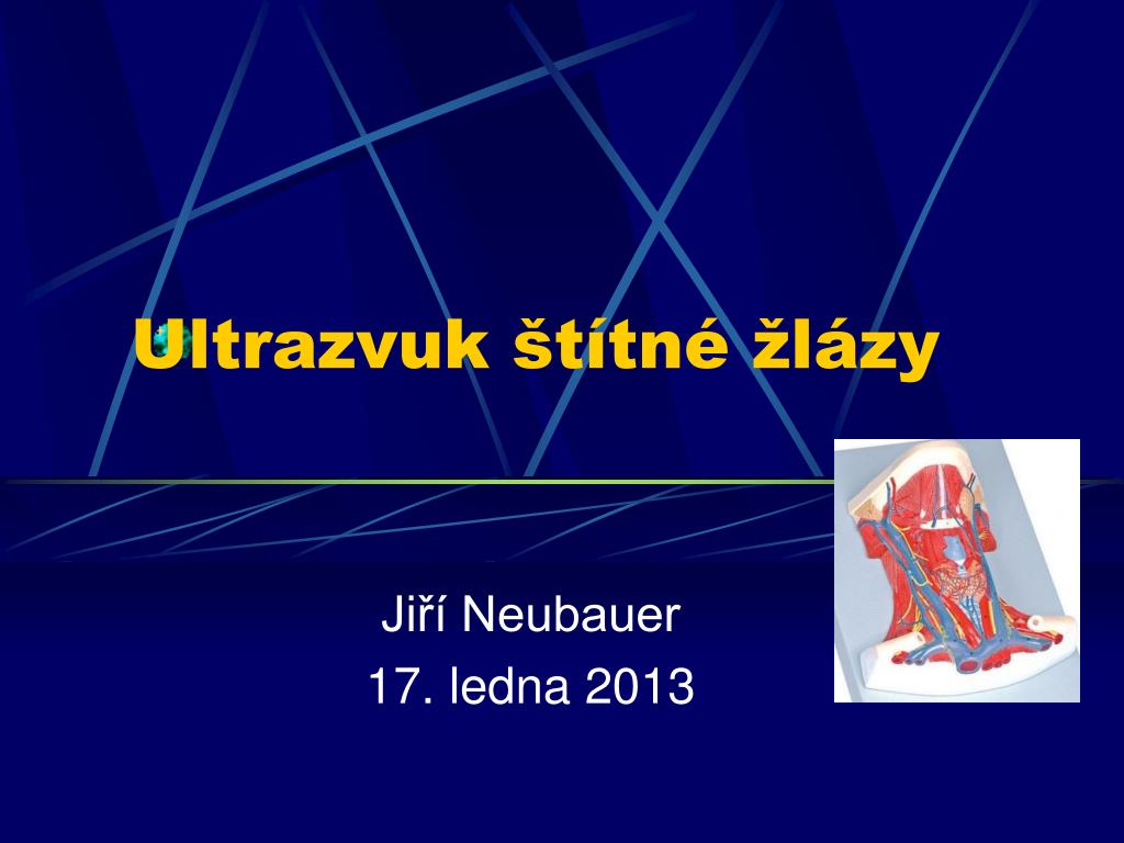 PPT - Ultrazvuk štítné žlázy PowerPoint Presentation, free download -  ID:3385336