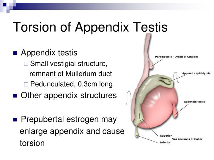 Ppt Urolithiasis Syndrome Of Swollen Scrotum Powerpoint