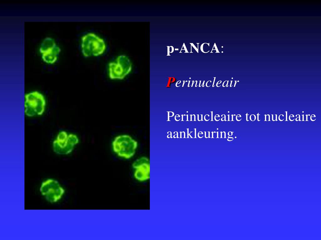 P Anca Pattern PPT - The use of antineutrophil antibodies in the diagnosis and ...