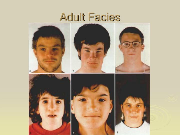 Adult alcoholic child syndrome thank Realize, what Adult alcoholic child syndrome something is