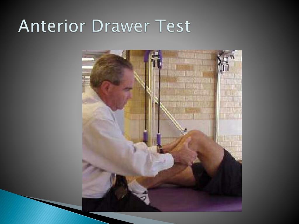 PPT Tibial Femoral Joint (Knee) PowerPoint Presentation, free PPT Tibial Femoral Joint (Knee) PowerPoint Presentation, free