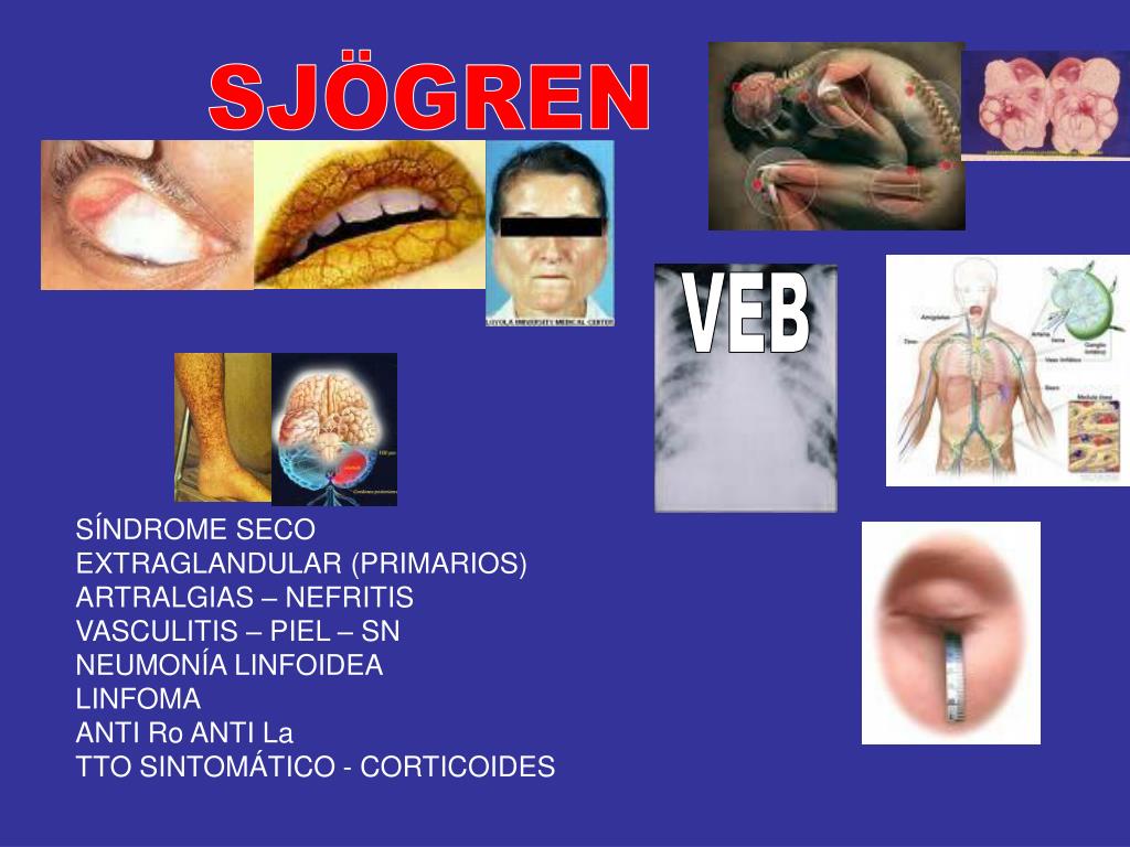 Para que se usan los corticoides Para que se usan los corticoides