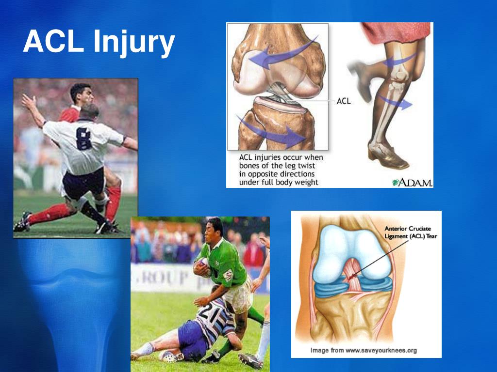 PPT - Clinical Anatomy of the knee PowerPoint Presentation, free