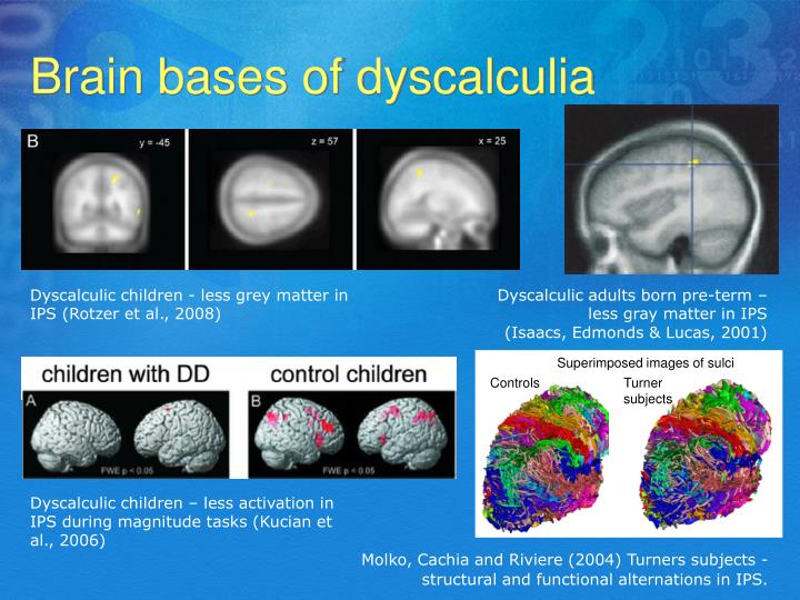 Dyscalculia in adults Final, Dyscalculia in adults