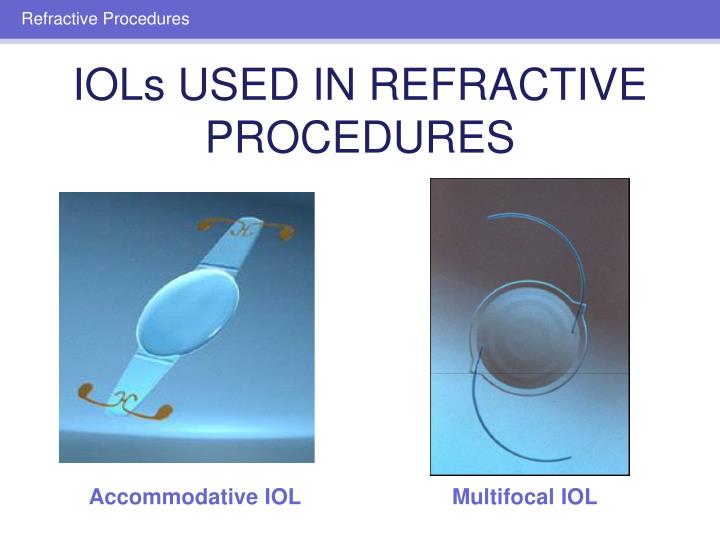 PPT - Refractive Surgery PowerPoint Presentation - ID:3398255