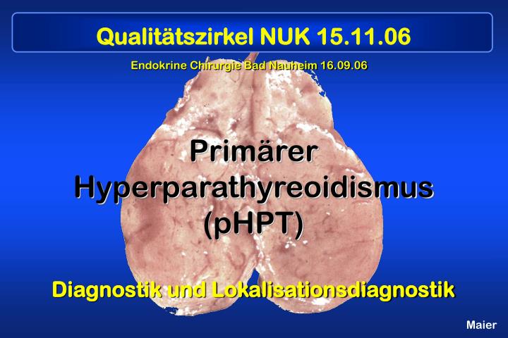 PPT - Primärer Hyperparathyreoidismus (pHPT) Diagnostik und ...